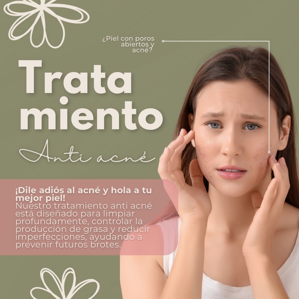 Tratamiento Anti-Acne at EJ Beauty Center in Norfolk, VA