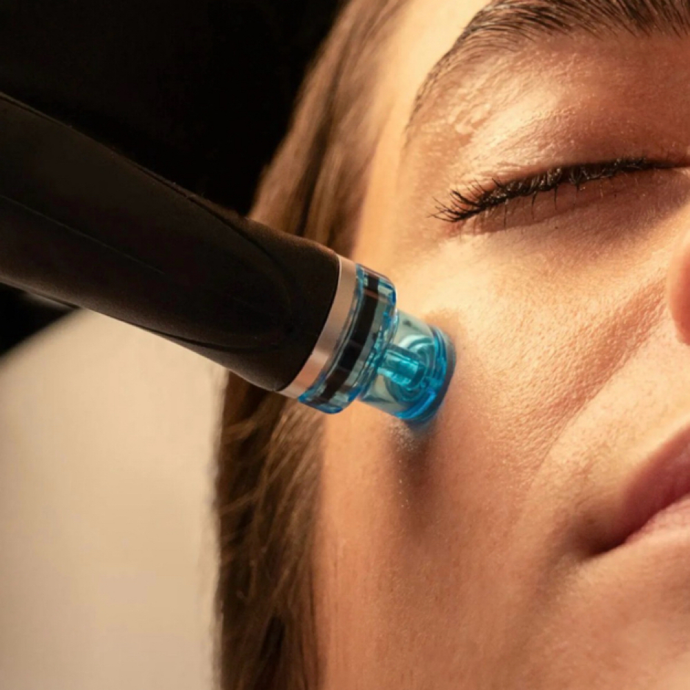 Hydro-dermabrasion at REMAKE BEAUTY STUDIO in San antonio, TX