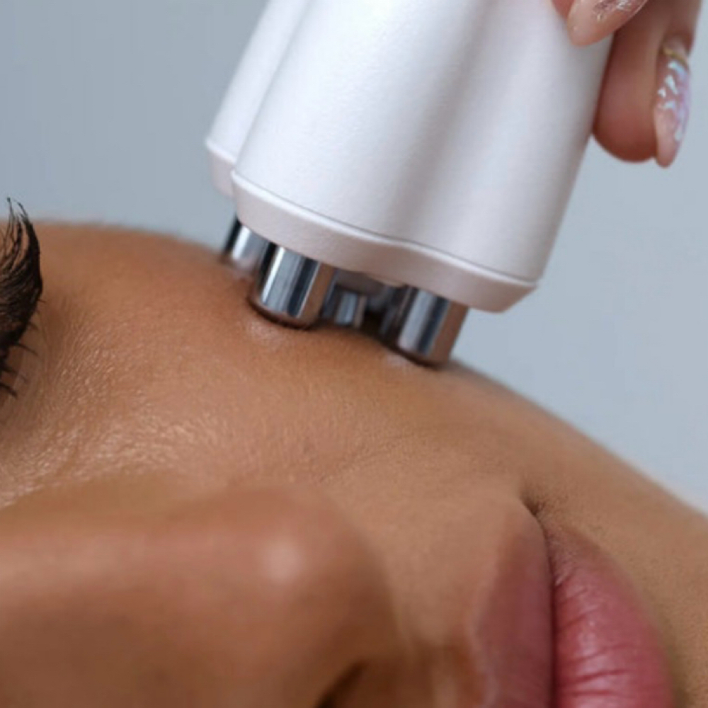 Rf Skin Tightning Consult at 227 Aesthetics in Sterling Heights, MI