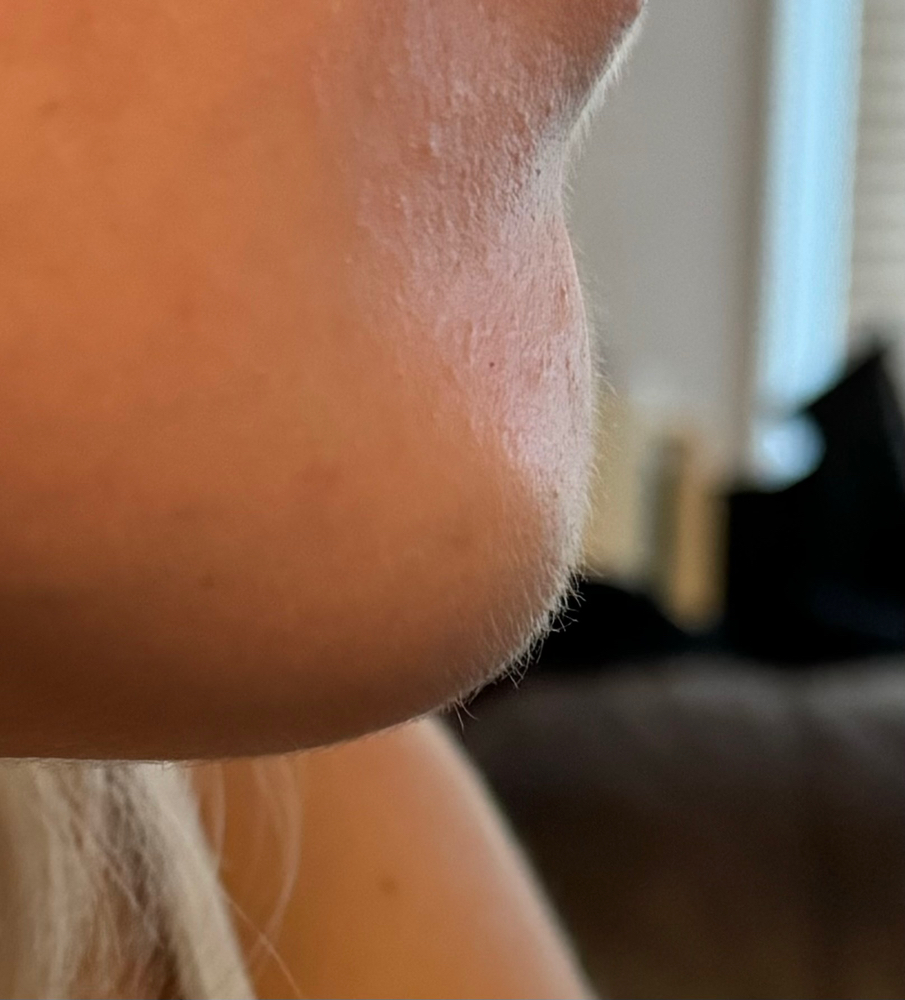 Chin