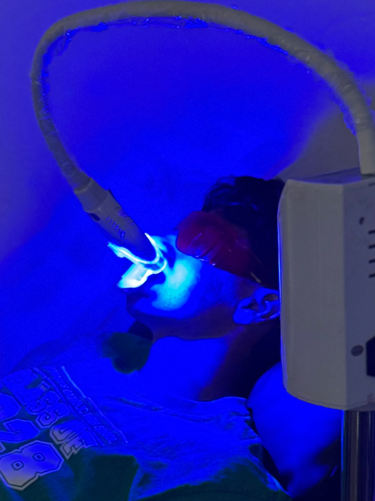 Proffesional Teeth Whitening
