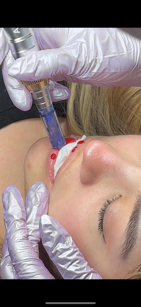 Lip Hydration Therapy at The Esthie Haus in West Jordan, UT