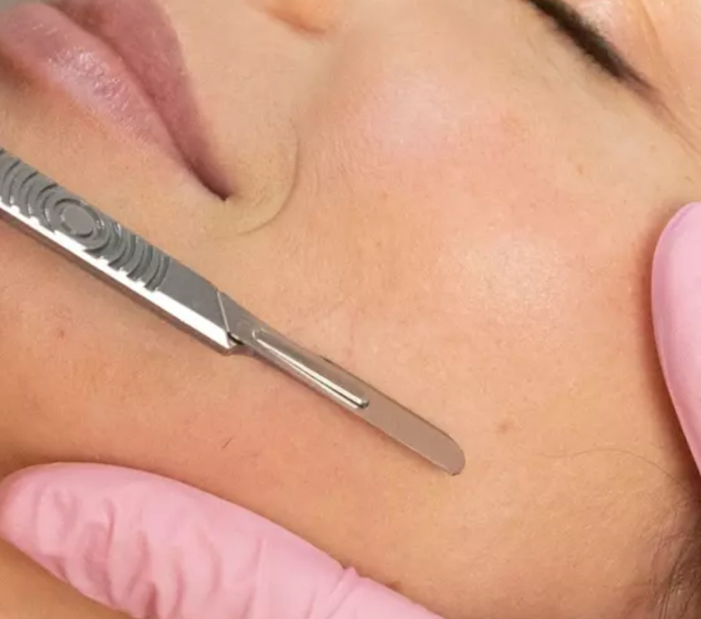 Dermaplaning