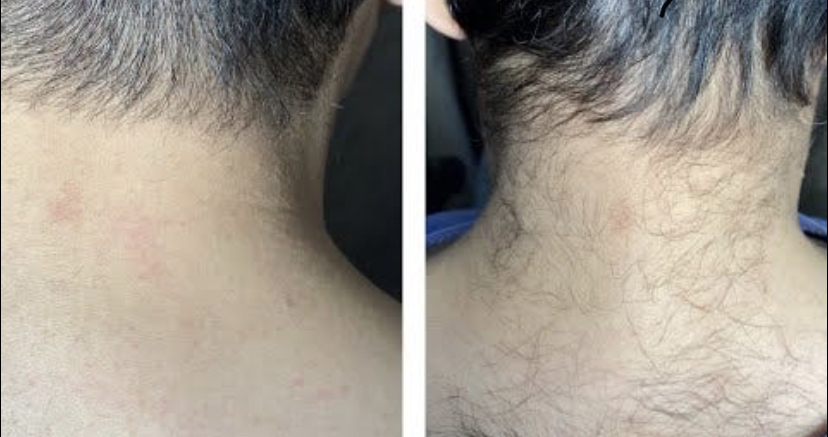 Neck