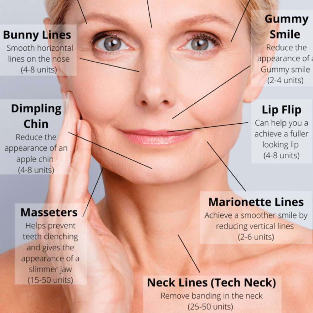 DAO's (botox) at Abigail Espinoza in Angleton, TX