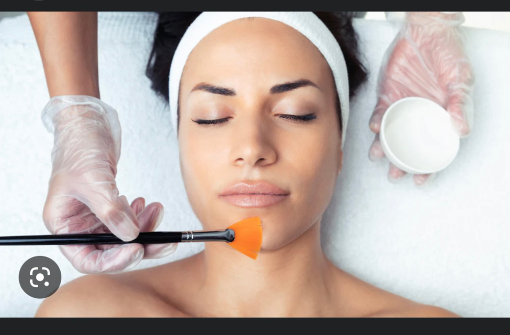 Peel Facial