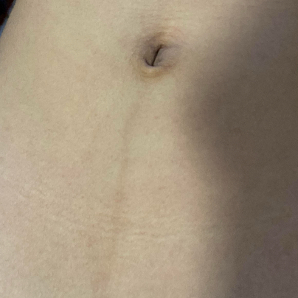 Happy Trail at iSugar Waxing Studio in Redondo Beach, CA
