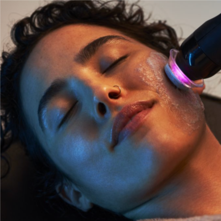 Glo2 SPECIAL (reg.$295) NOW $199 at Ultimate Solutions Medical Spa in Stamford, CT