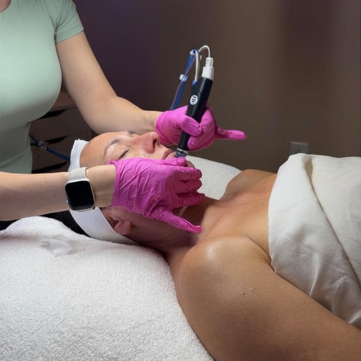 Platinum HydraFacial at Vanity Beauty in Saratoga Springs, NY