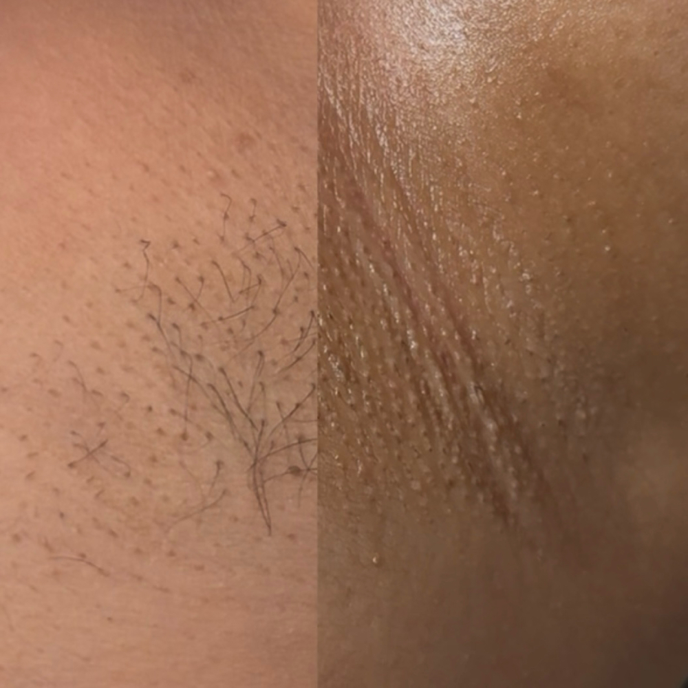 Underarm Wax