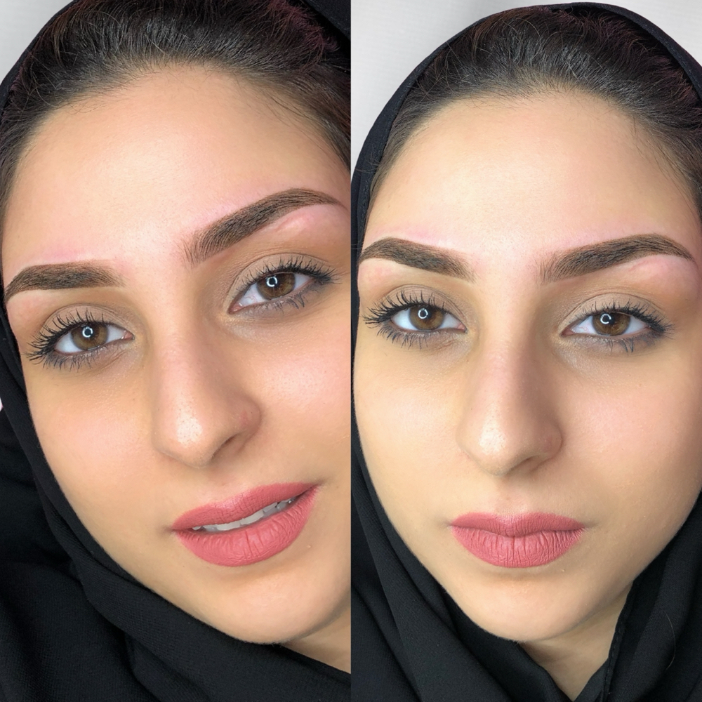 Micro-pigmentation eyebrows