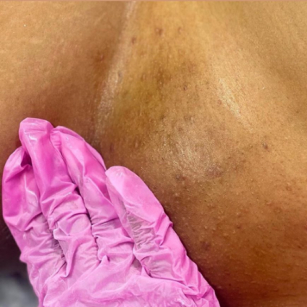 BRAZILIAN WAX at Esthiology Skin Lab in Nottingham, MD