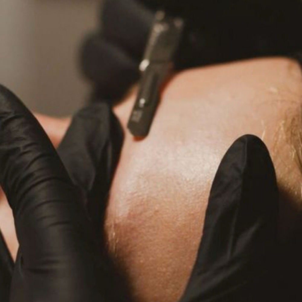 K-Dermaplane Deluxe Facial at Caza Seoul in Lakewood, CO