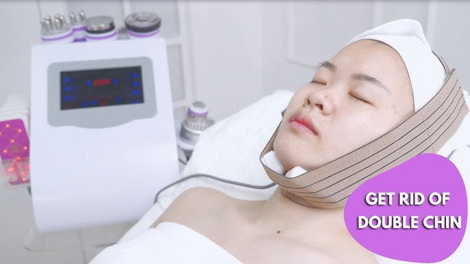 Chin Laser Lipo