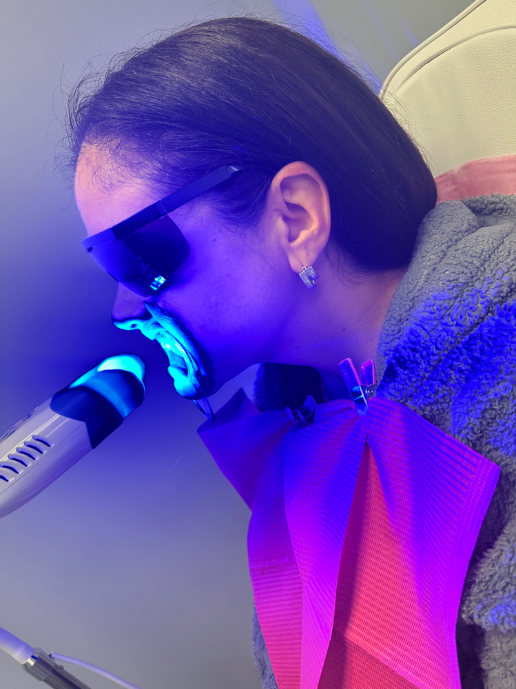 Teeth Whitening