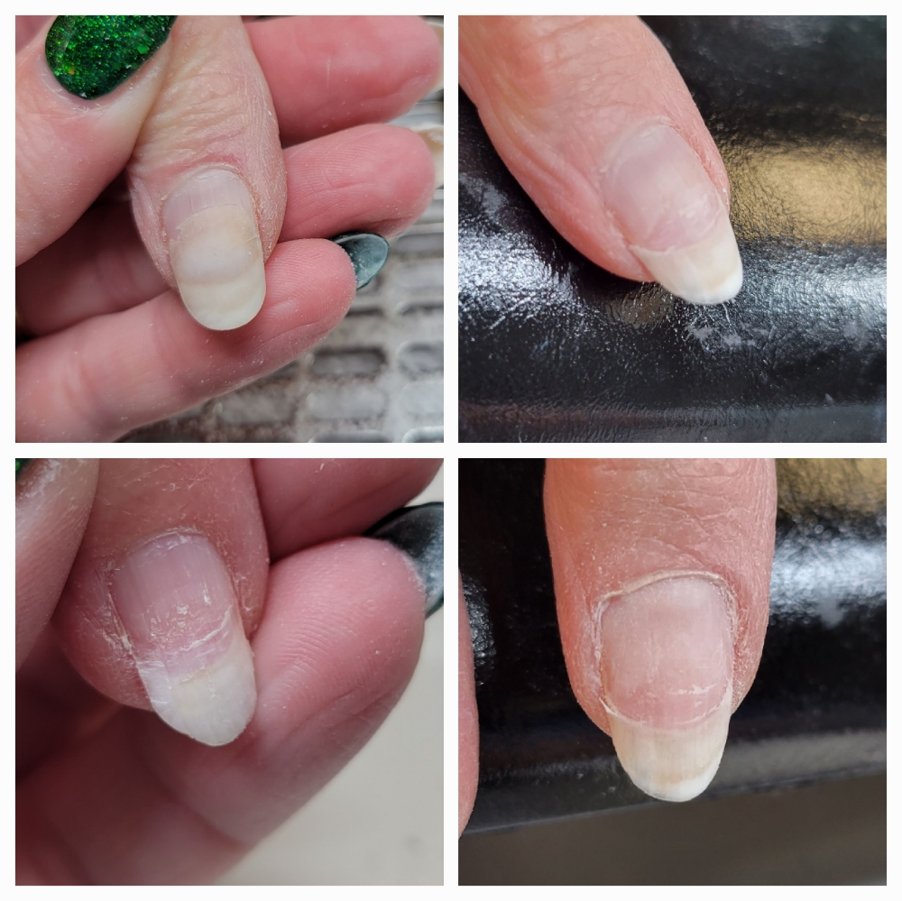 Nail Repair: with a service