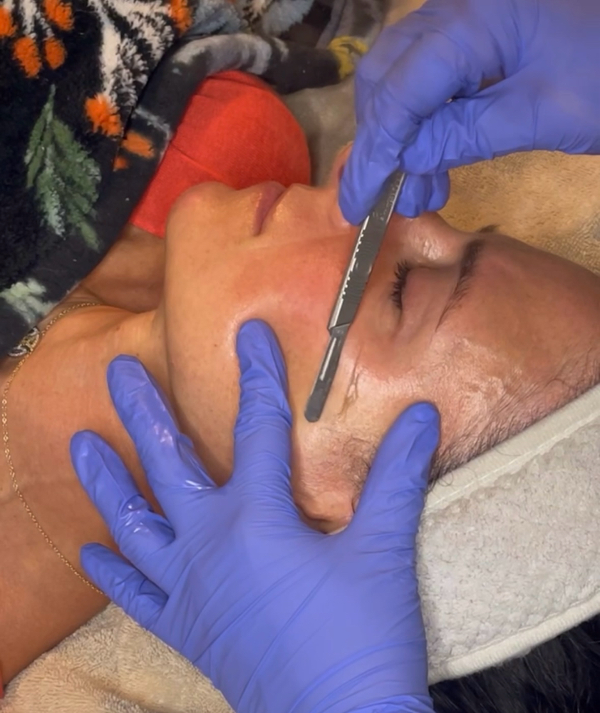 Dermaplane Signature
