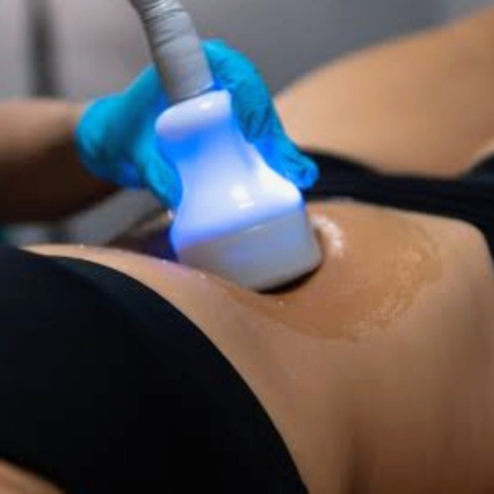 Cryo Slimming | Sculpt & Define at Top Tier Massage & Wellness LLC in Abingdon, MD