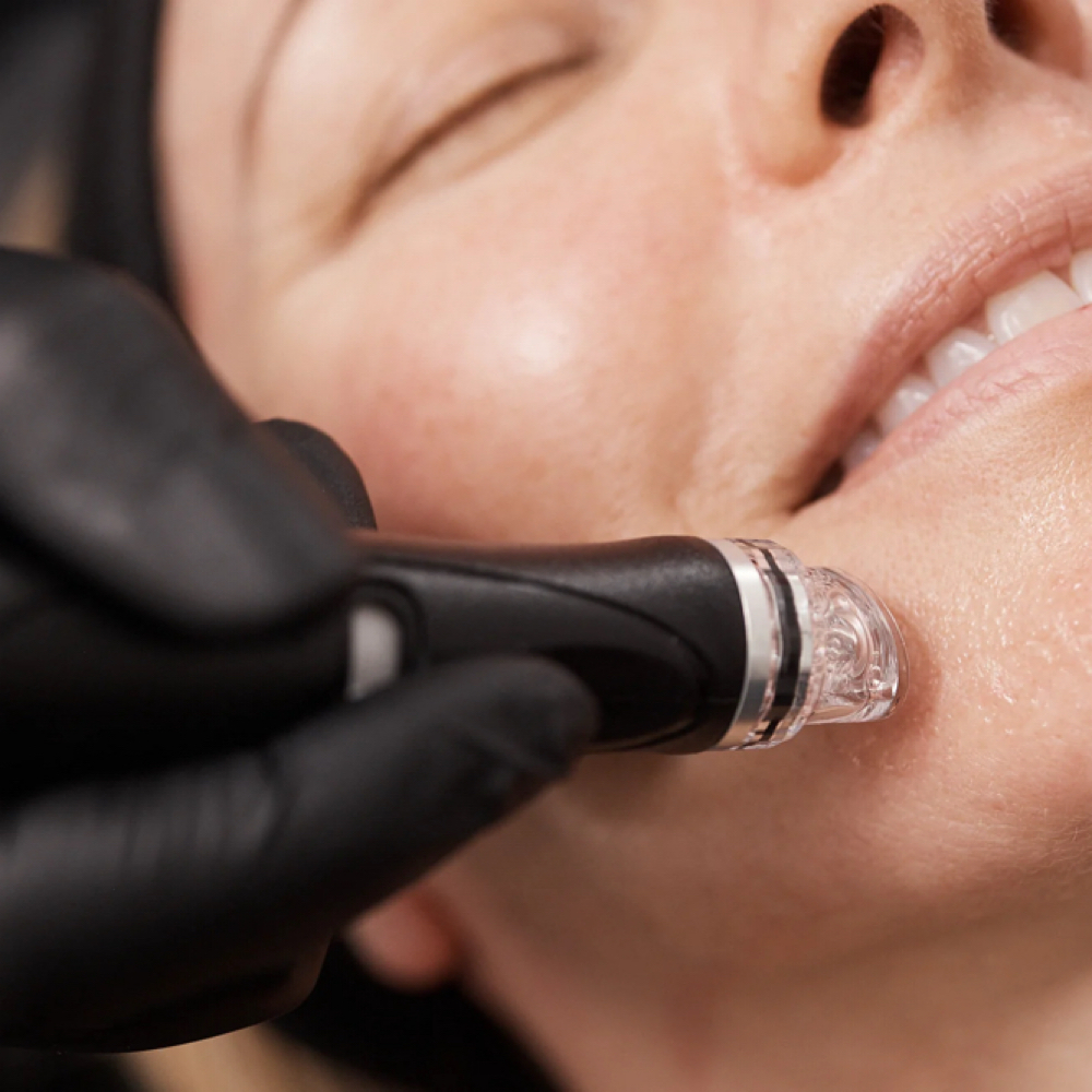 Hydrafacial Xpress (45 Mins) at APMU MED SPA | Atlanta Aesthetics & Permanent Makeup in Marietta, GA