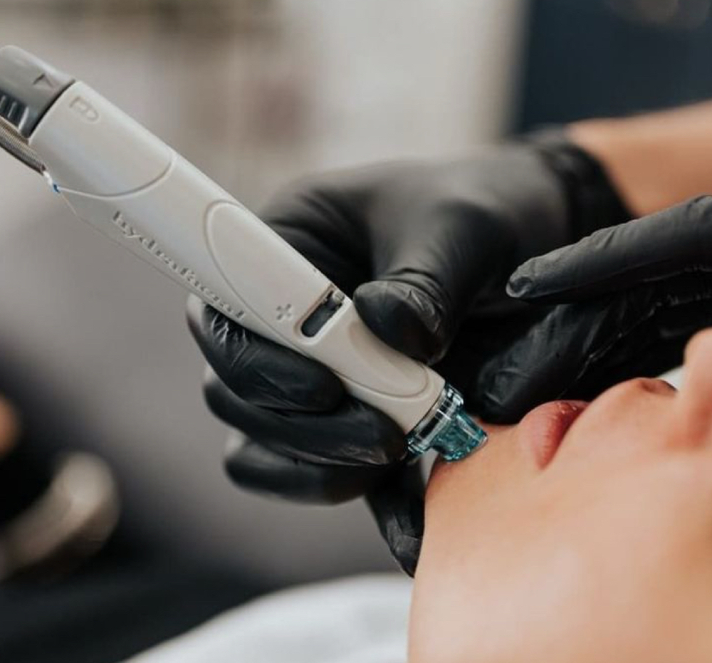 Hydra Facial