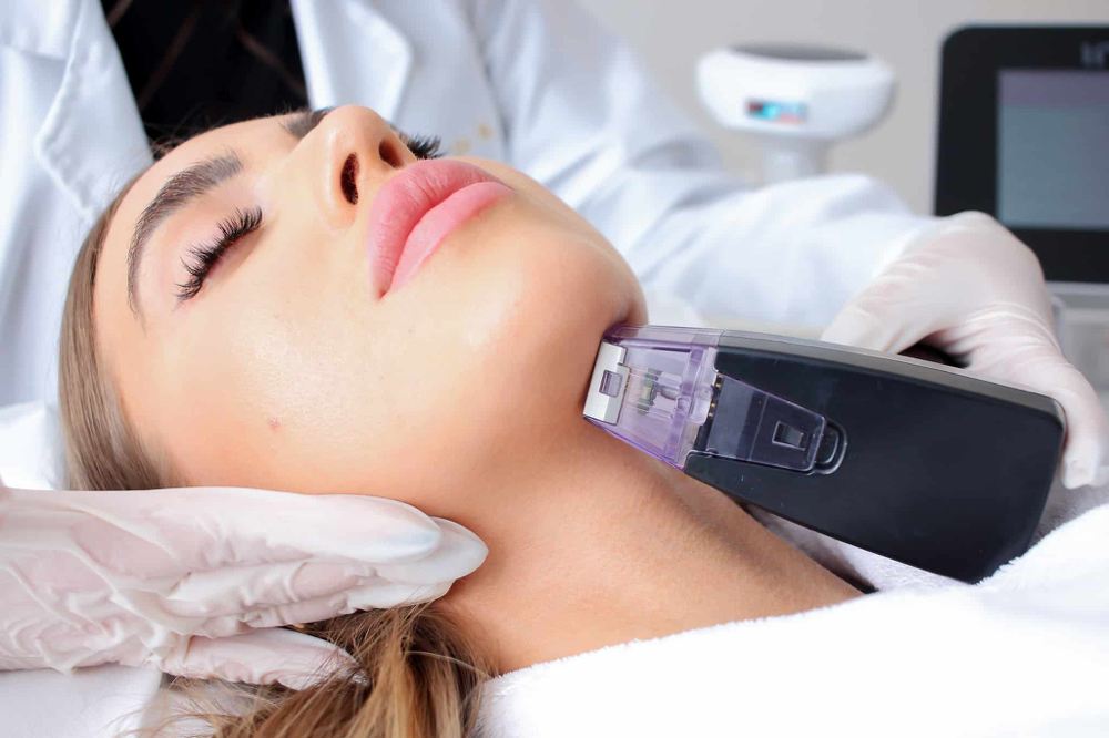 RF Microneedling - Morpheus8