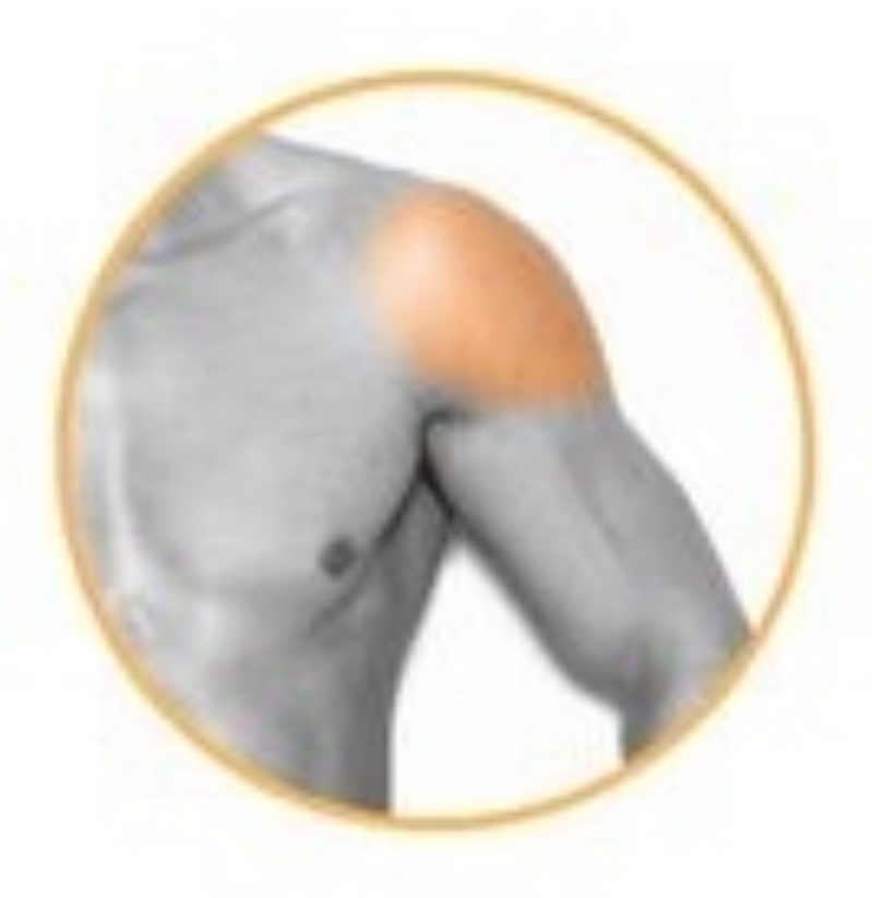 SHOULDERS Laser Hair Removal