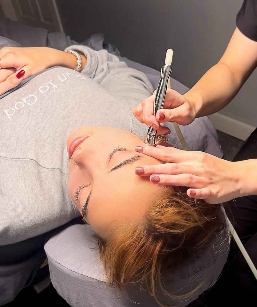 Microdermabrasion at Redeemed Massage and Esthetics