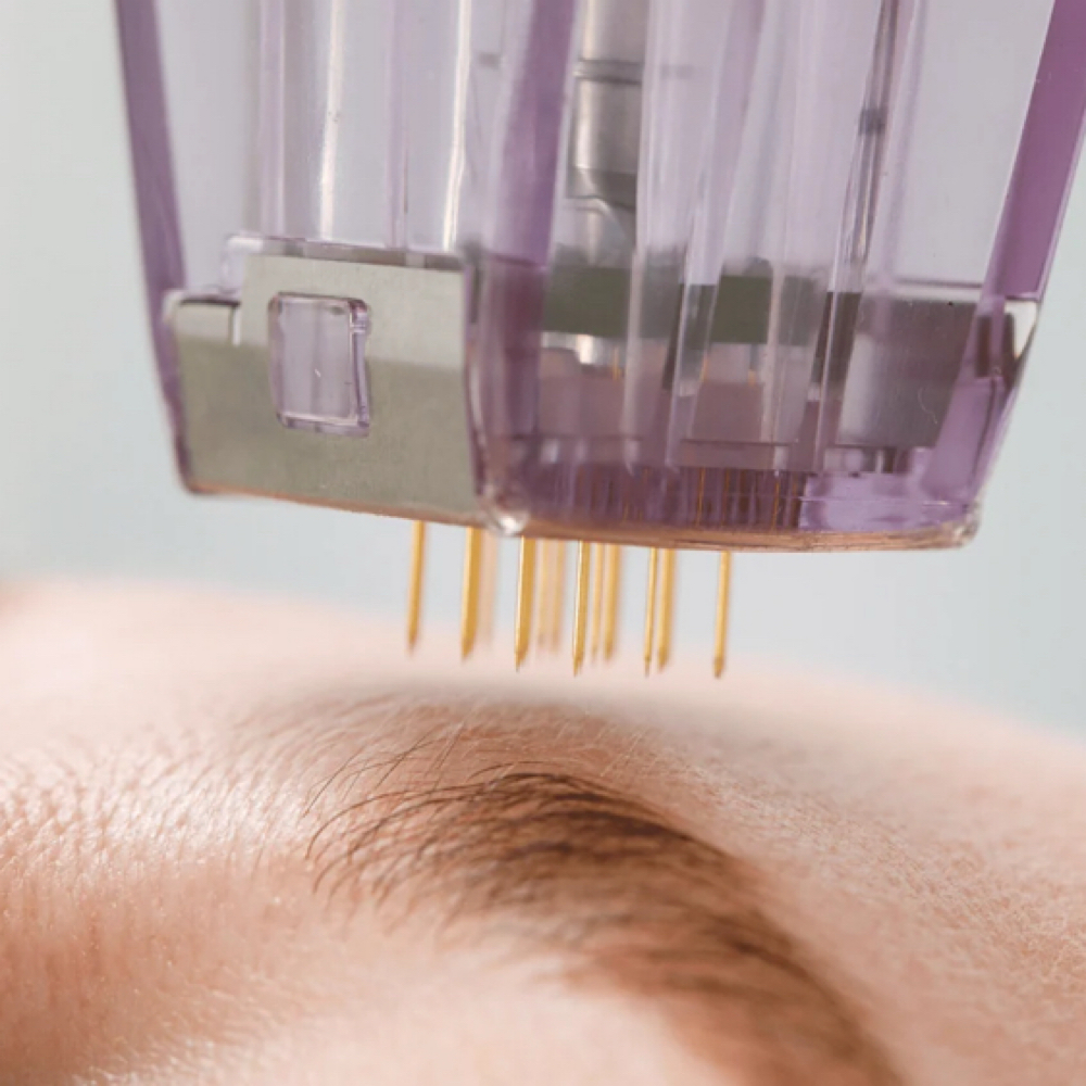 Rf Microneedling at Skin And Beauty By Elle in Livonia, MI