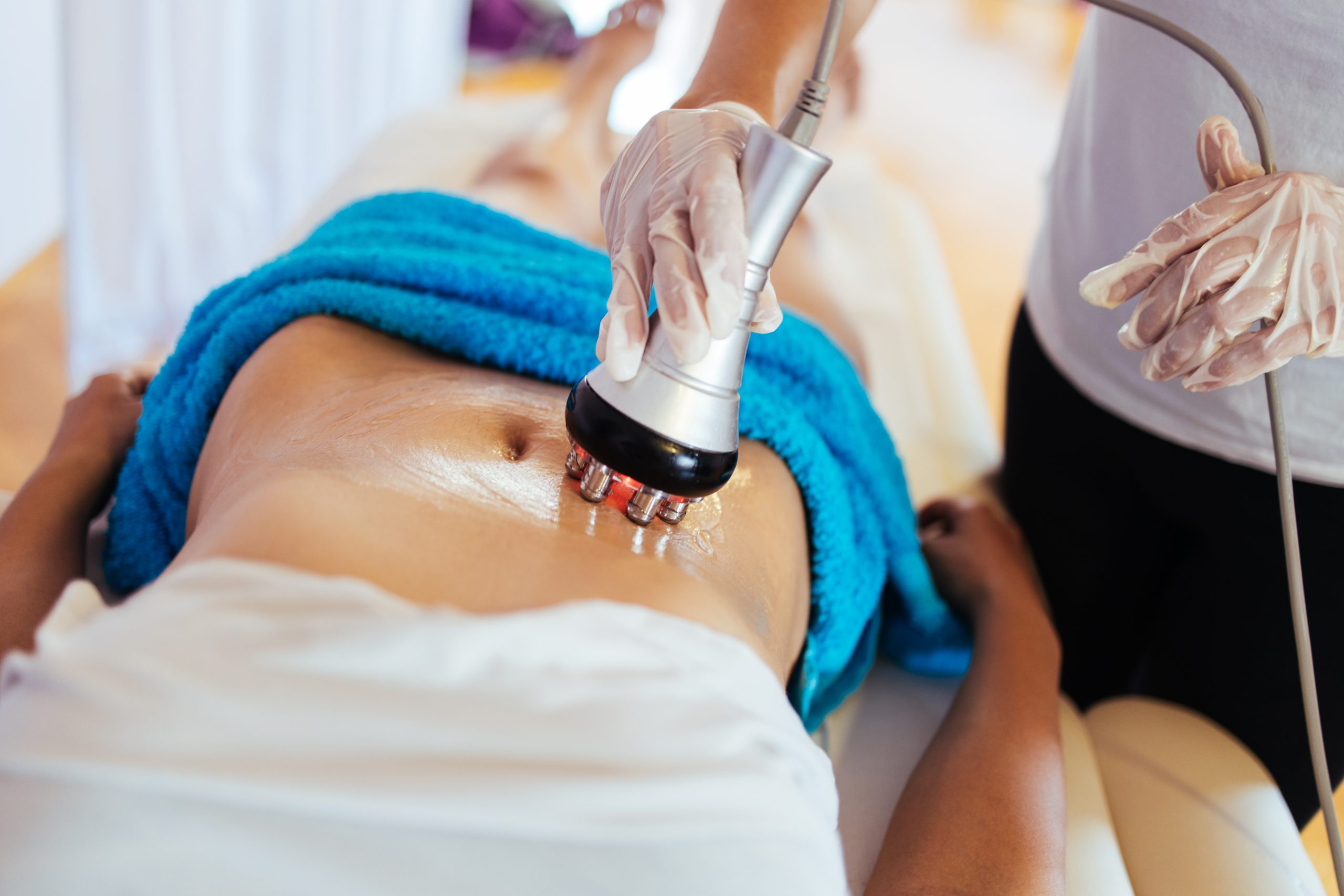 RADIOFREQUENCY SKIN TIGHTENING at 3B Wellness Boutique in Jensen Beach, FL