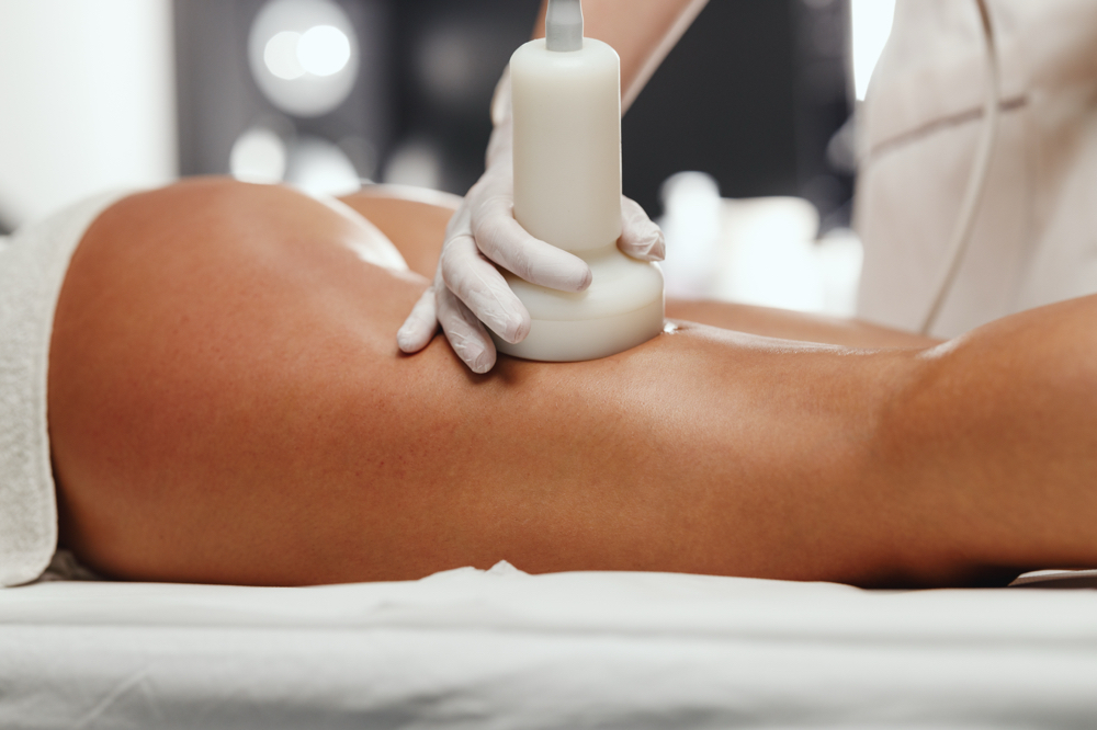 Cellulite Package - 4 Sessions