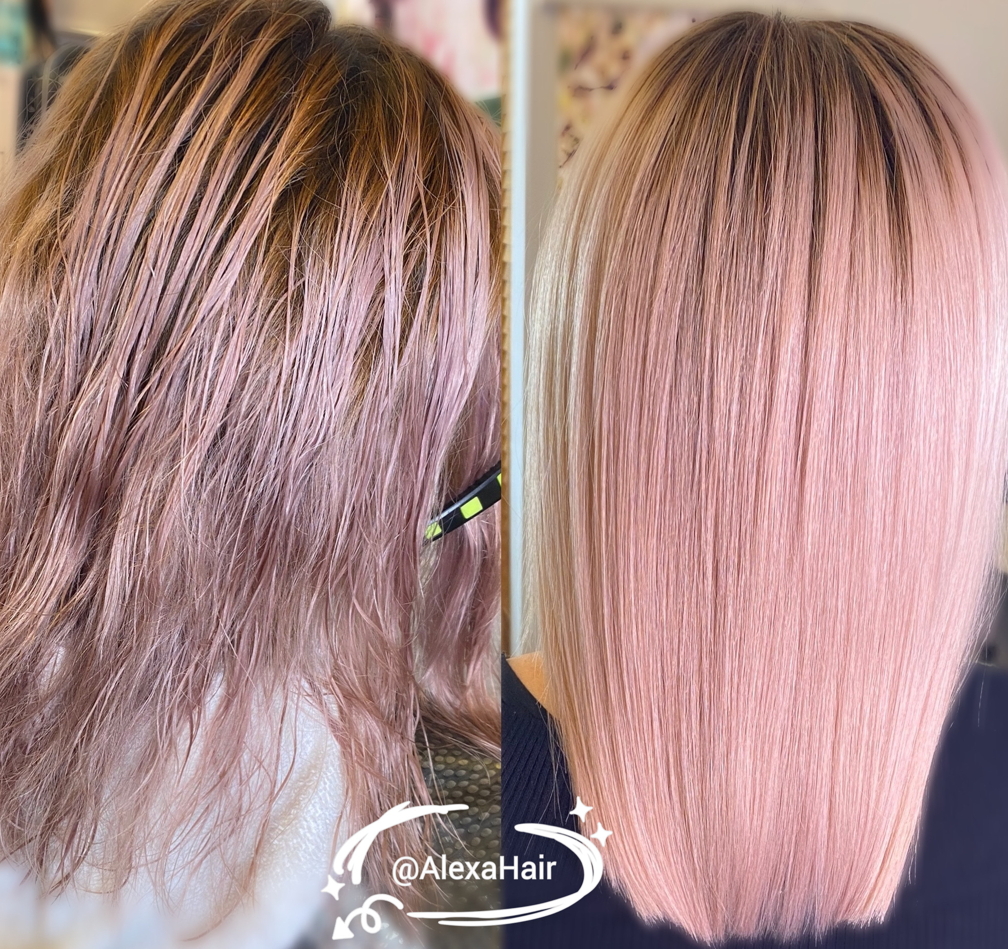 Alisado Cirugia Plastica De Cabello