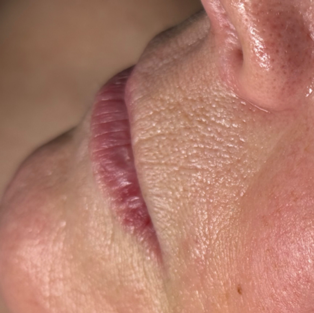 Lip Wax at MadSkin Esthetics in Colorado Springs, CO