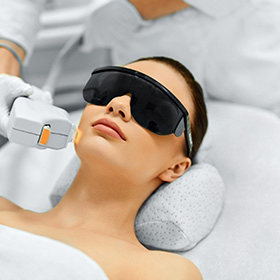 Rejuvenecimiento facial Con laser