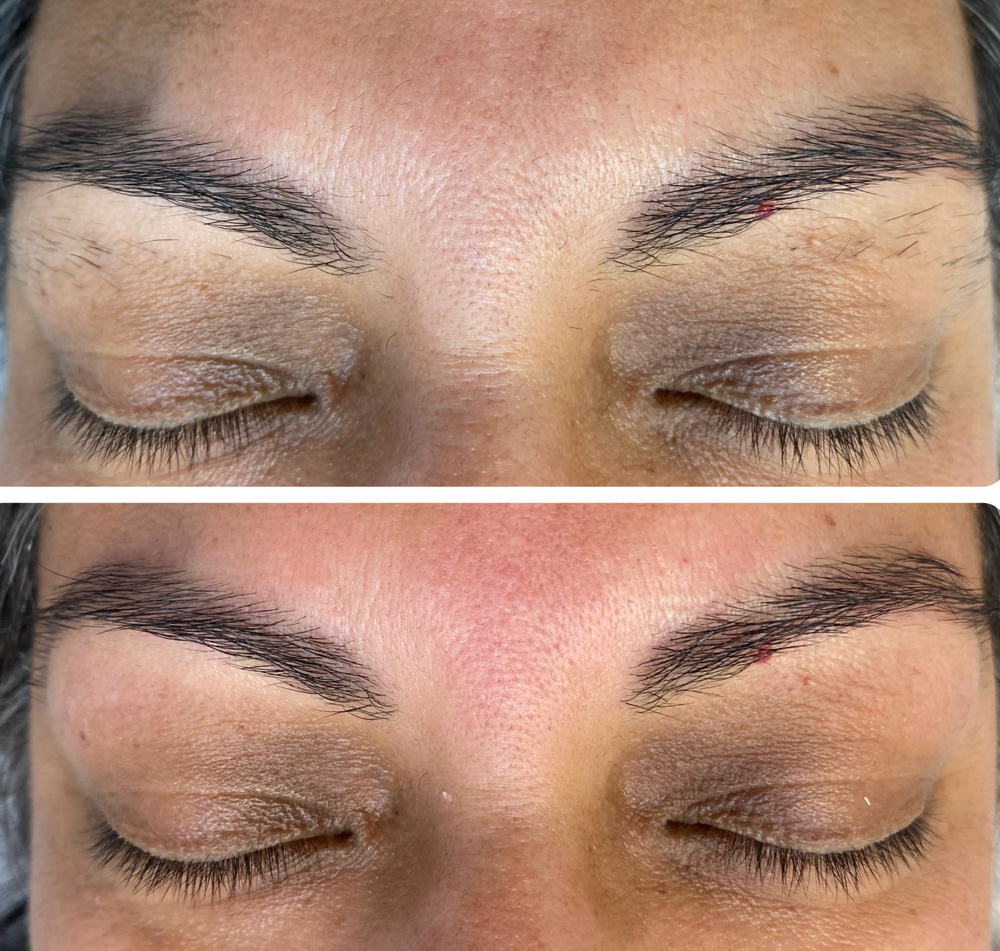 Eyebrows