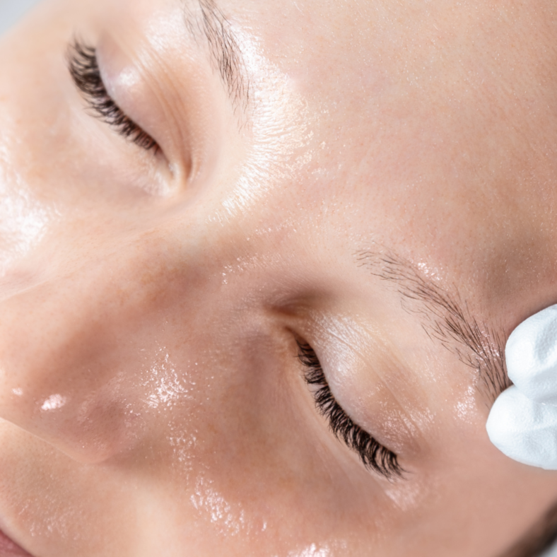 MICRO-CHANNELING - FUNDAMENTAL FACE at Inner Glow Skin Care in Conifer, CO