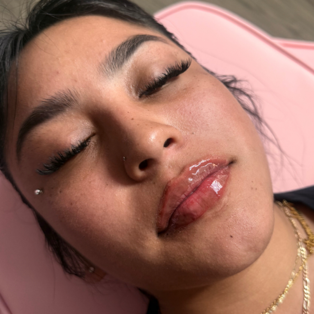 Nano Needle Touch Up 0.5ml💉👄 at Dolls.luxury.lips in Chicago, IL