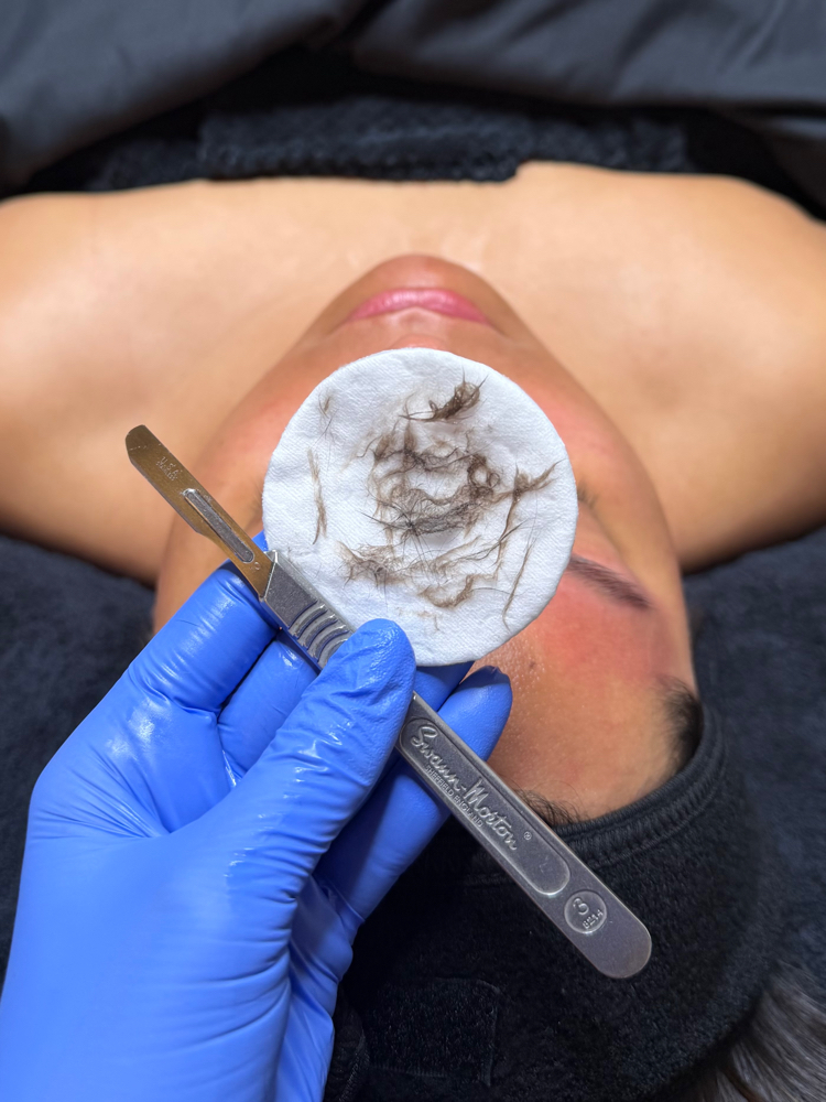 DERMAPLANE ADD ON FOR FACIALS
