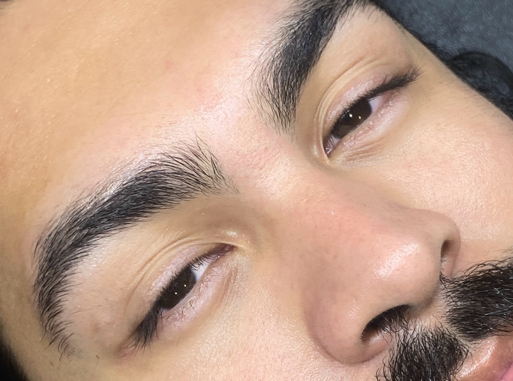 Unibrow