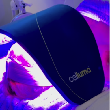 Red Light Therapy at Fitzskin in Gilbert, AZ