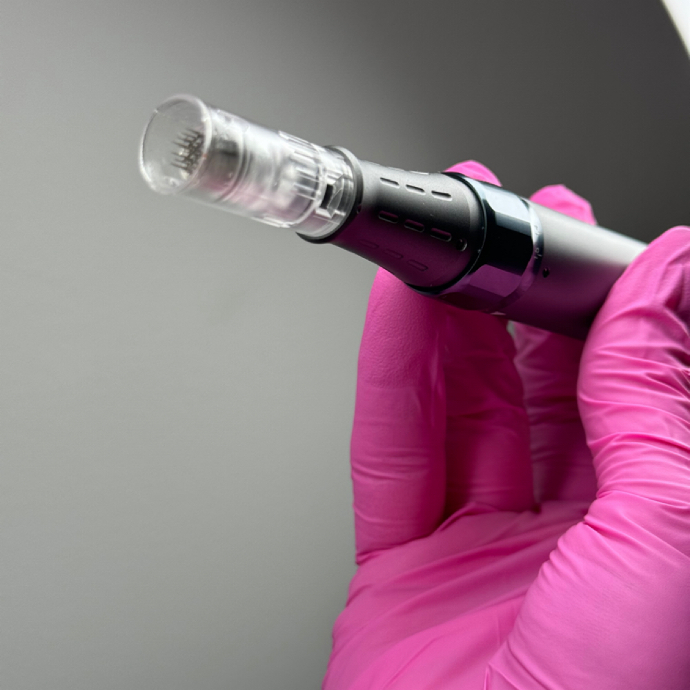 Microneedling | Targeted Session at Marina Rocha Esthetics in Greensboro, NC
