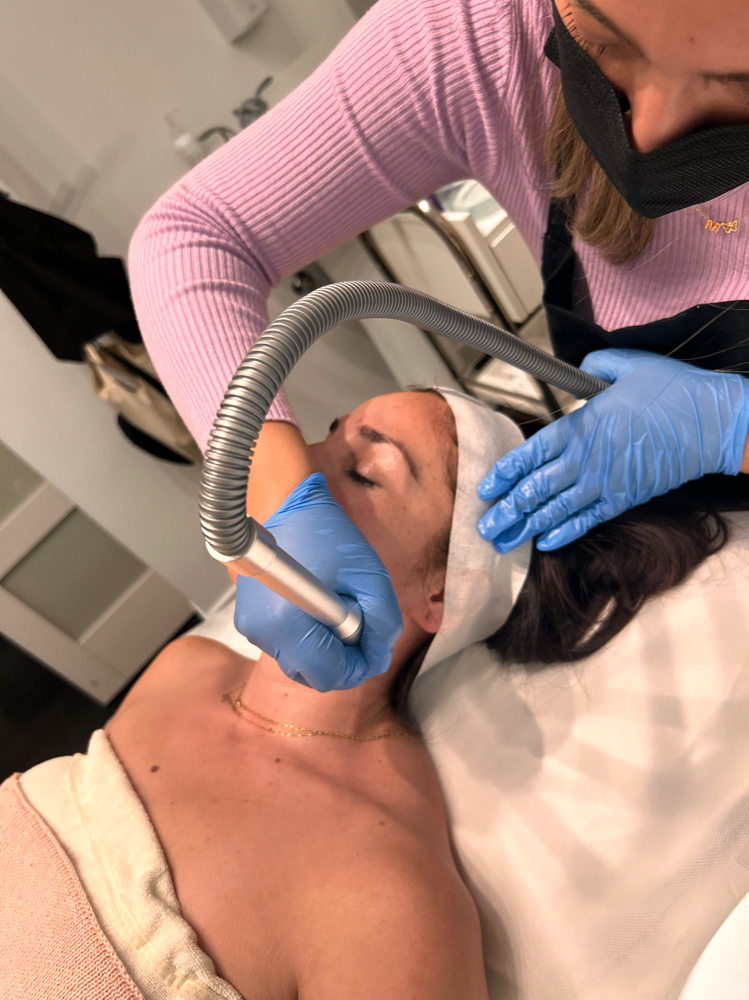 Microdermabrasion Facial at SKNBM in San Diego, CA