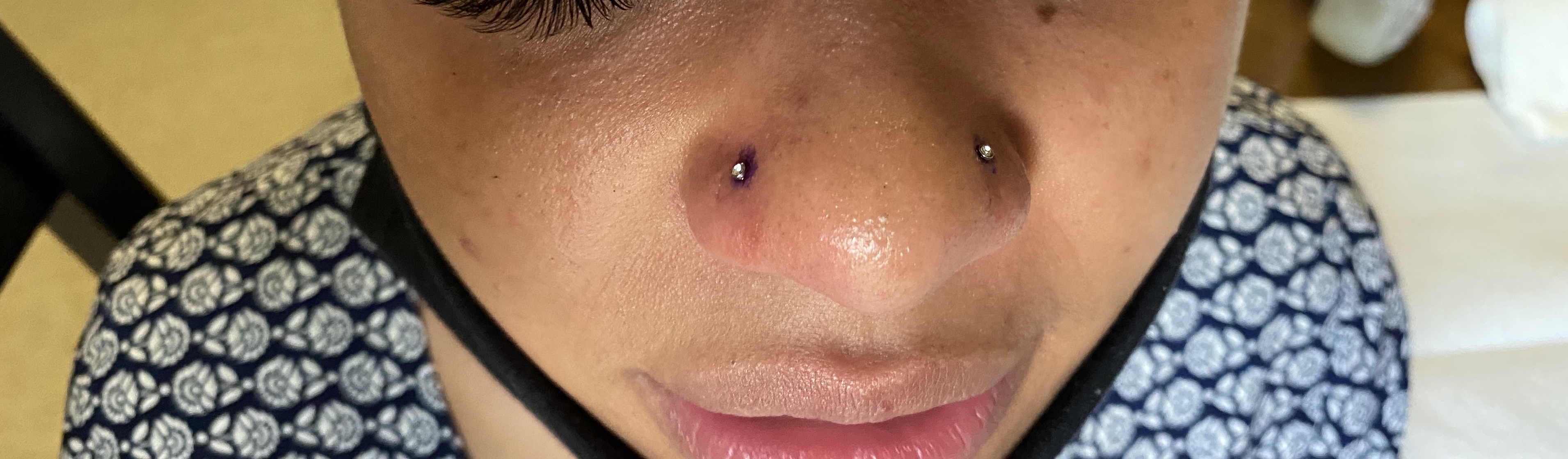 Double Nose #1