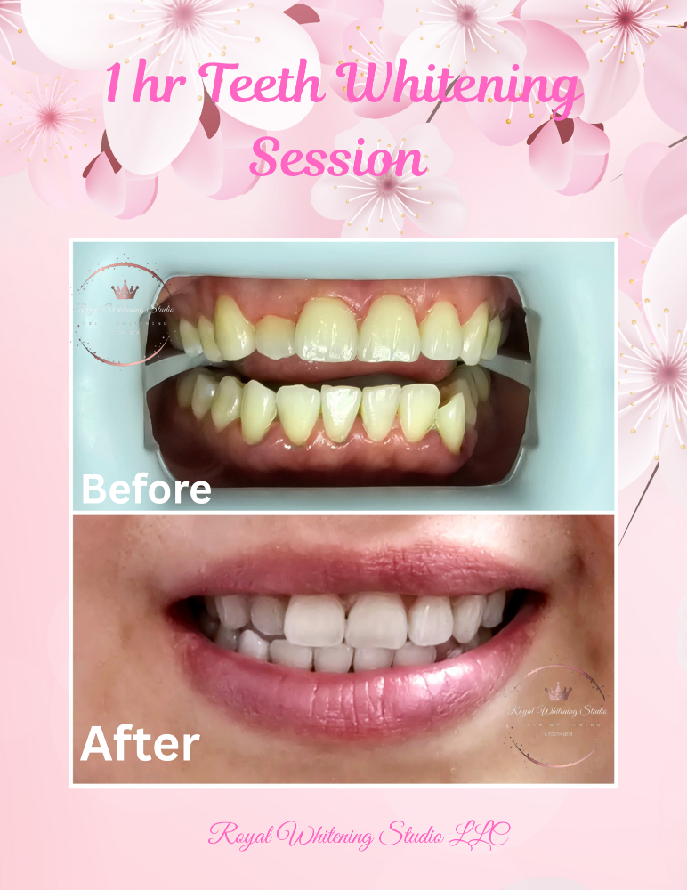 1 Hr. Clear Whitening