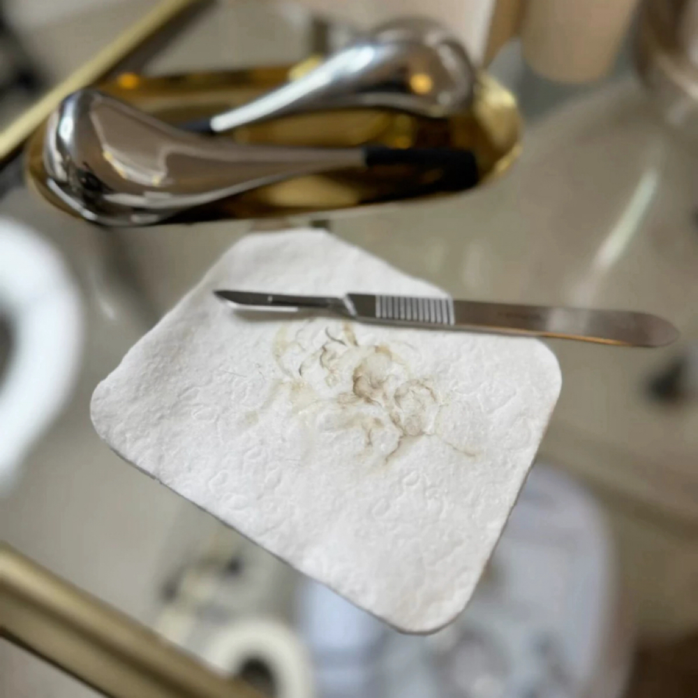 Dermaplane Radiance Facial at Piel Studio in Fullerton, CA