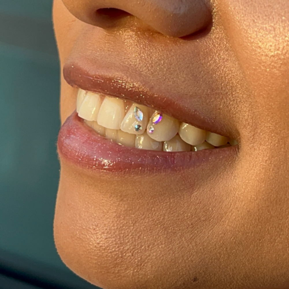 Starry Bites Decortive Tooth Gems at StarGirl Studio in Vancouver, WA