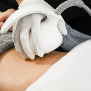 Skin Tightening - Venus RF