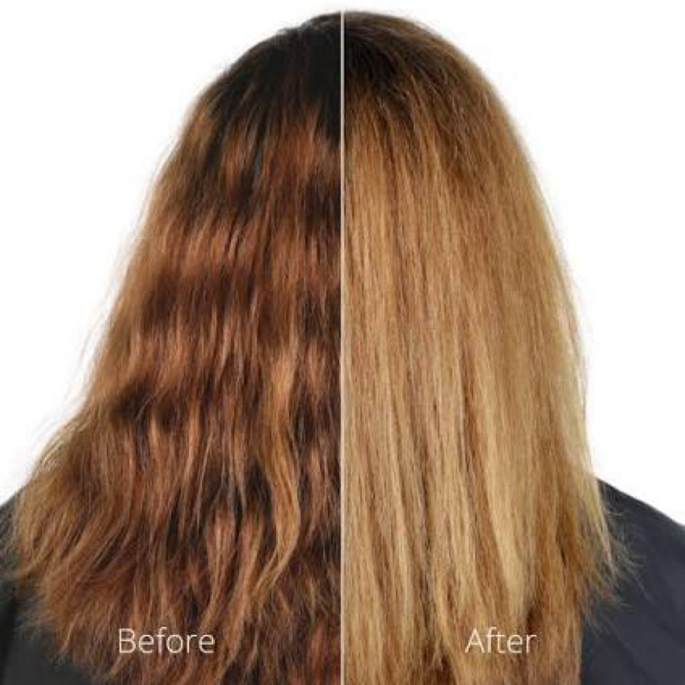 Malibu CPR Treatment