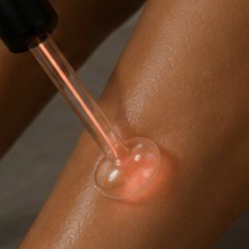 Vajacial Treatment at Body Wax Edit in Kennewick, WA