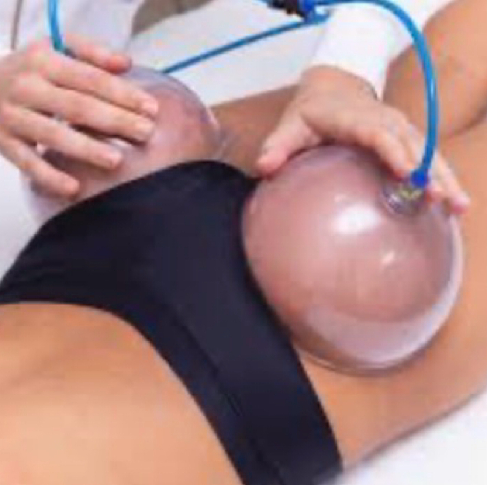 Butt Lift Therapy at Healing Goddess Masseuse LLC in Houston, TX