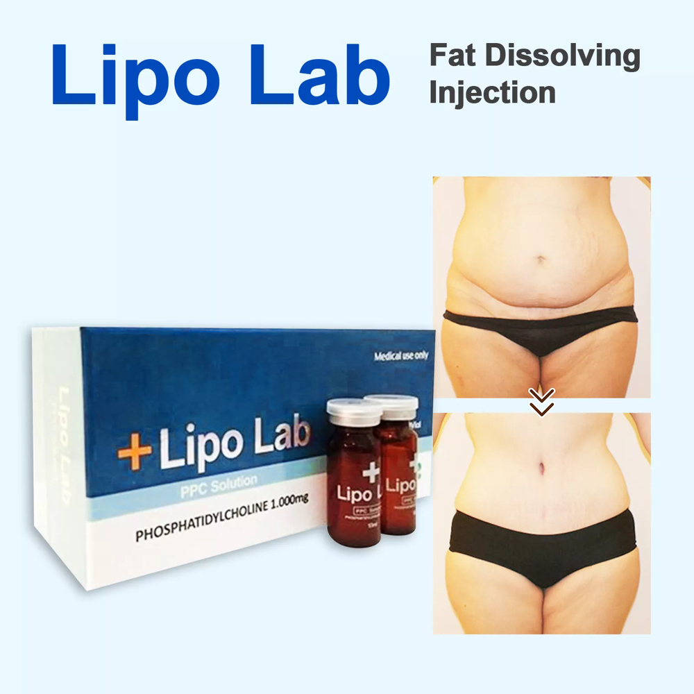 Lipo PPC Injection: Fat Melting